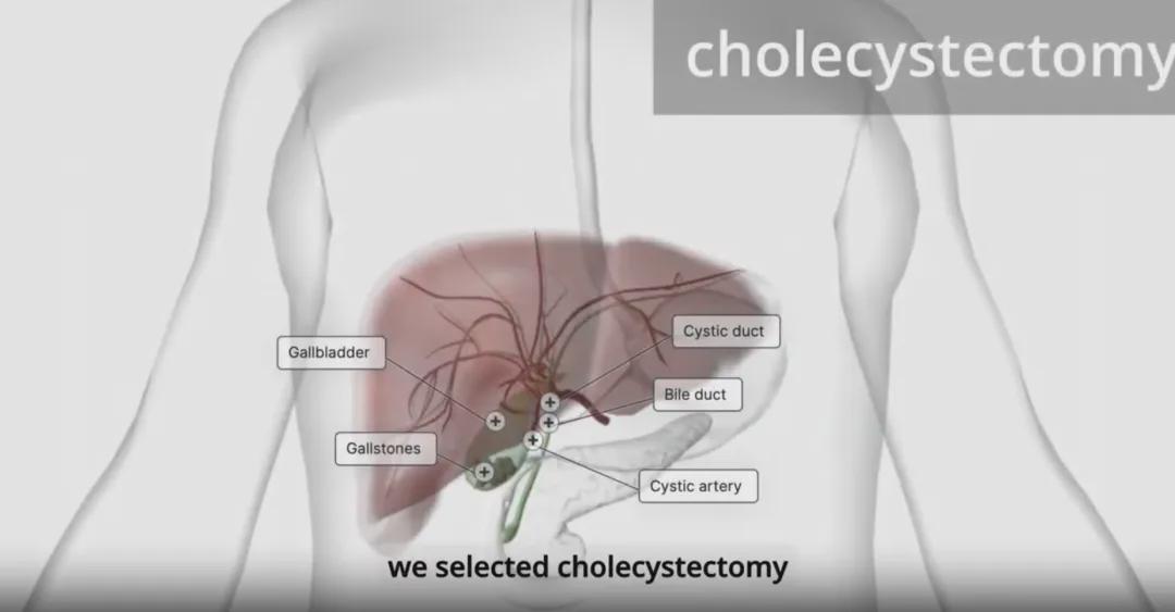重磅！Science子刊最新封面！里程碑突破：机器人首次自主手术100%成功！(图4)
