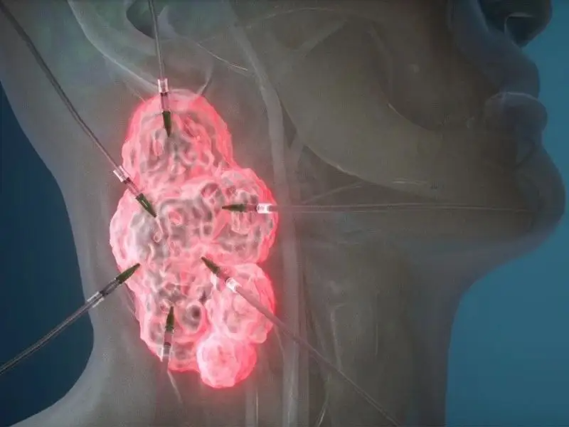 你见过经口机器人吗？港中文发表综述，介绍这一医疗器械最新进展(图1)